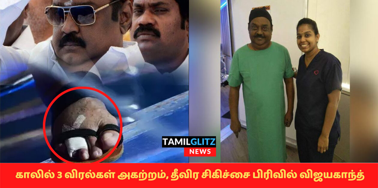 உடலில் ரத்த ஓட்டம் சீராக இல்லை..காலில் 3 விரல்கள் அகற்றம்..மனவேதனையில் தொண்டர்கள் 39