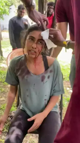 "சண்டை காட்சியில் தாறுமாறாக விழுந்து தலையை உடைத்து கொண்ட நடிகை சம்யுகதா"!! 7