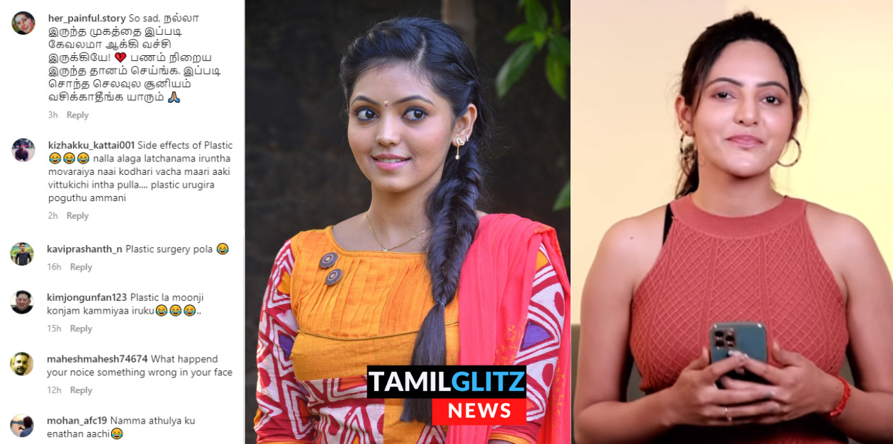 பிளாஸ்டிக் சர்ஜரிக்கு பின் அடையாளமே தெரியாமல் மாறி போன அதுல்யா ரவி.! 51