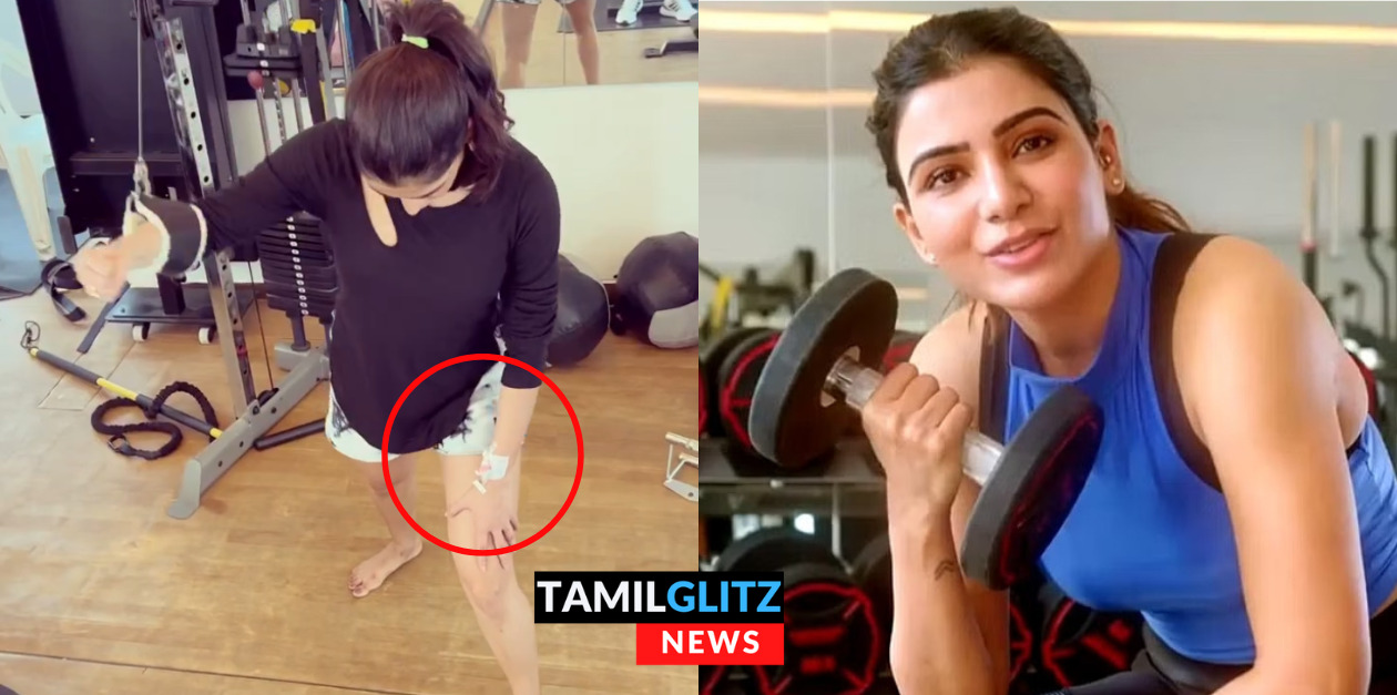 கையில் ஊசியுடன் வெறித்தனமாக ஒர்க் அவுட் செய்யும் சமந்தா.! உங்க hardworkக்கு பெரிய சல்யூட் 91