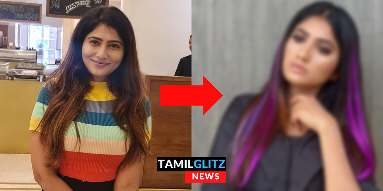 பிளாஸ்டிக் சர்ஜரி செய்து முகப்பொலிவை இழந்த பிக்பாஸ் ஜூலி.! விகாரமாக மாறிய தோற்றம்.! 87