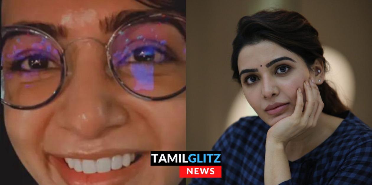 சமந்தாவா இது? என்ன இப்படி ஆயிட்டாங்க? புகைப்படத்தை பார்த்து, அதிர்ச்சியில் உறைந்த ரசிகர்கள்.! 33