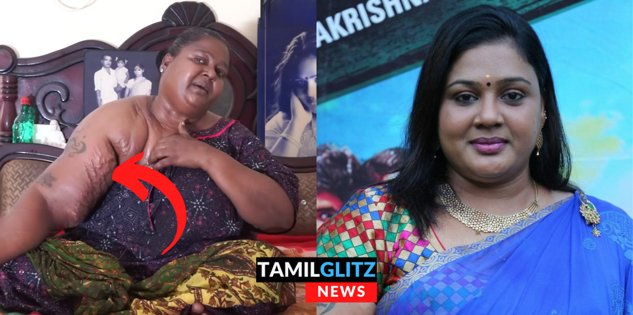 எனக்கு ஊசி போட்டு கருணை கொ லை பண்ணிடுங்க.! கதறி அழுத அங்காடி தெரு பட நடிகை சிந்து.! 25