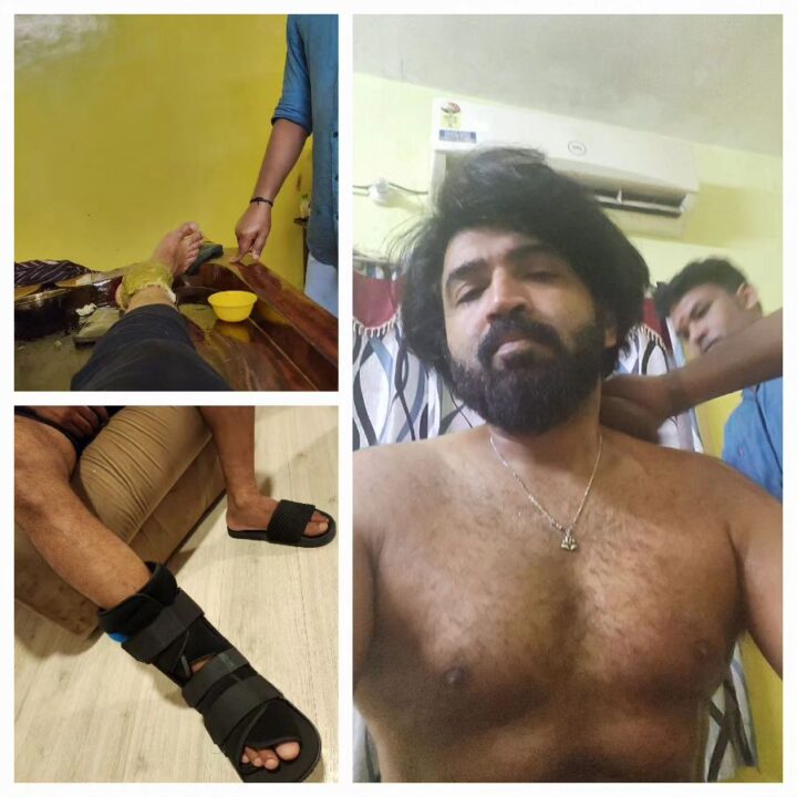 ஸ்ட்ரெச்சரில் வீட்டுக்கு தூக்கிவரப்பட்ட அருண் விஜய்..! அவருக்கு இதுதான் பிரச்சனையா? 7