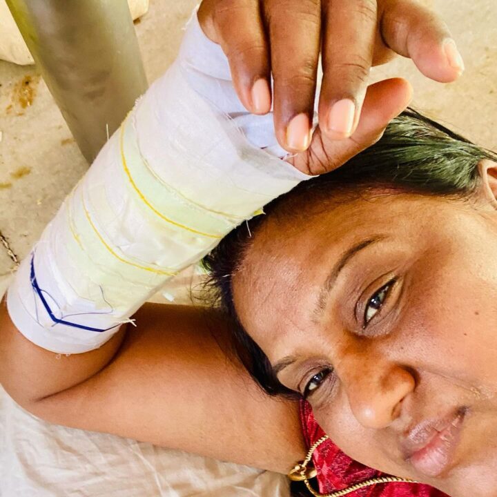 விபத்தில் சிக்கி படுகாயமடைந்த 'பாக்கியலட்சுமி' சீரியல் நடிகை.! வெளியான ஷாக்கிங் புகைப்படங்கள்.! 5