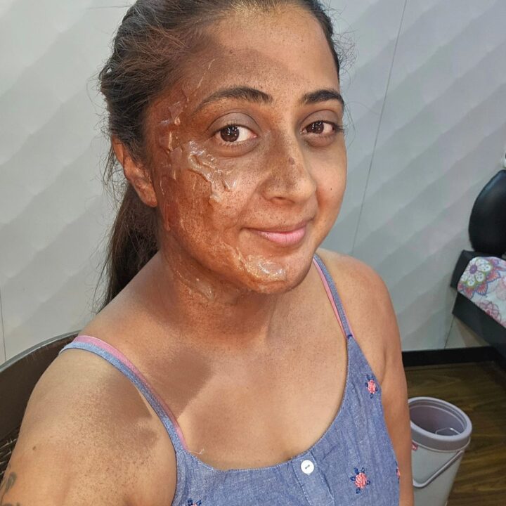 முகத்தில் தீ காயங்களுடன் எதிர்நீச்சல் சீரியல் நடிகை கன்னிகா..! வைரலாகும் அதிர்ச்சி கிளப்பும் புகைப்படம்..! 3